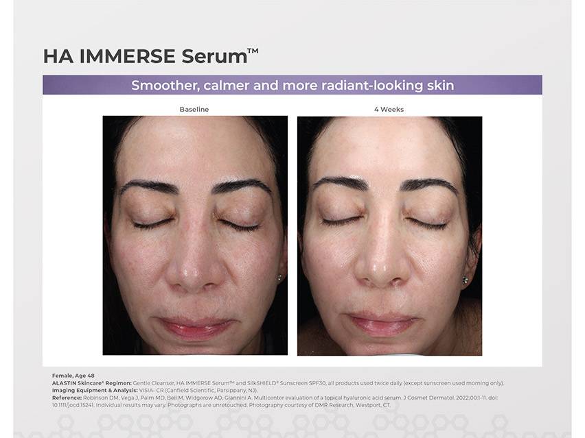 ALASTIN Skincare HA IMMERSE Serum