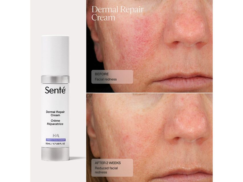 Senté Dermal Repair Cream
