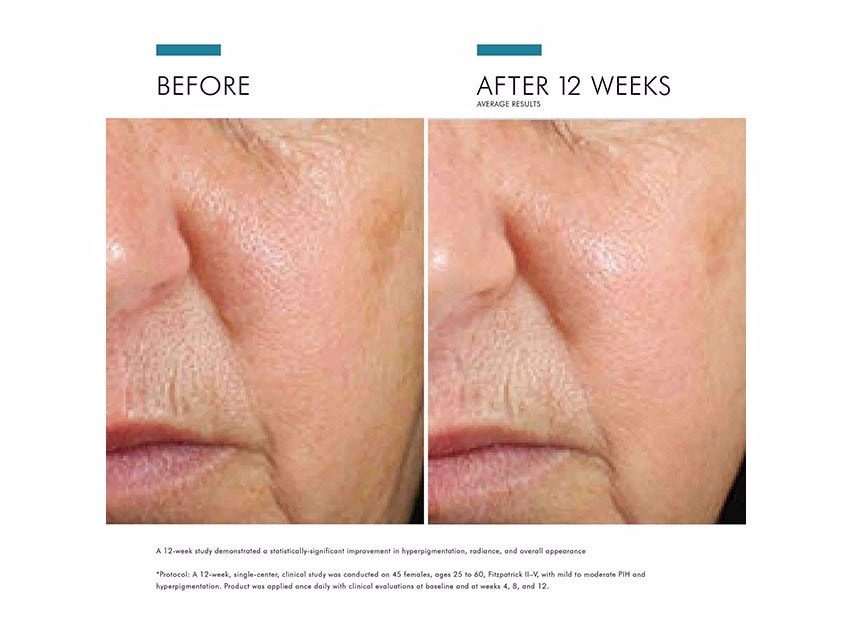 SkinCeuticals Daily Brightening UV Defense Sunscreen SPF 30