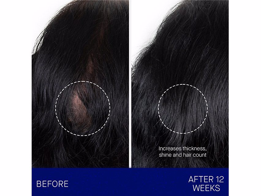 Augustinus Bader The Scalp Treatment