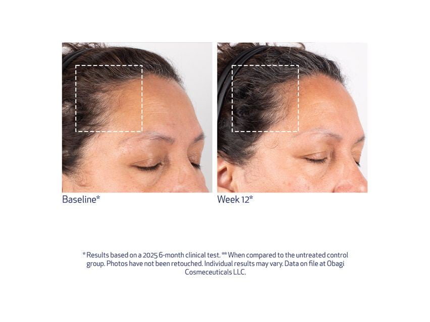 Obagi Nu-Cil BioStim Scalp Serum