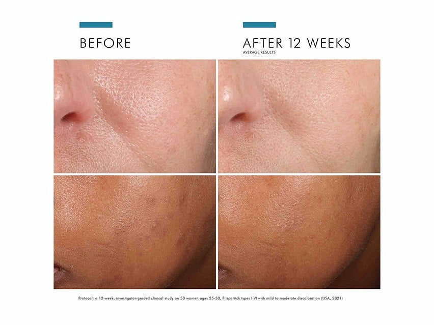 SkinCeuticals Phloretin CF Antioxidant Vitamin C Discoloration Serum