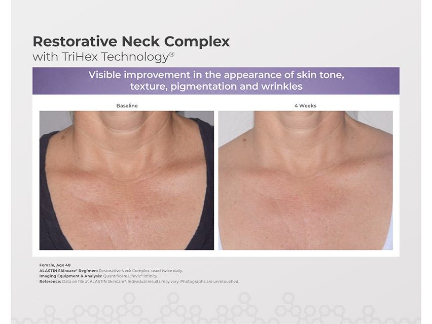 ALASTIN Skincare Restorative Neck Complex with TriHex Technology