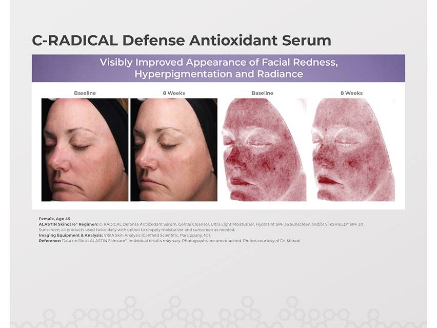 ALASTIN Skincare C-RADICAL Defense Antioxidant Serum