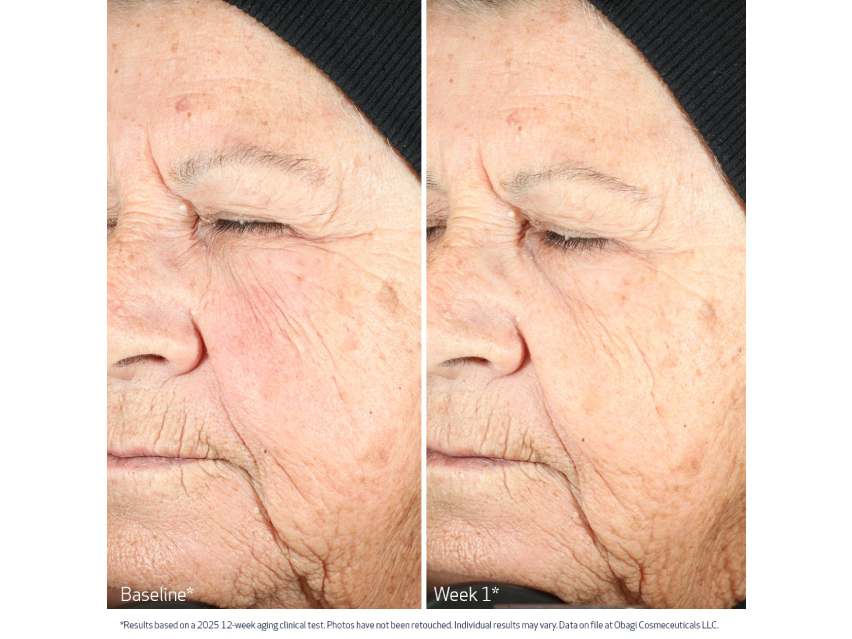 Obagi Nu-Gen Cellular Renewal Serum with NAD+