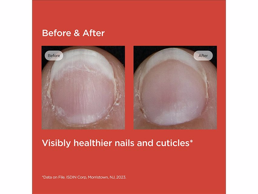 ISDIN Si-Nails Fast Absorbing & Hydrating Nail Serum Strengthener