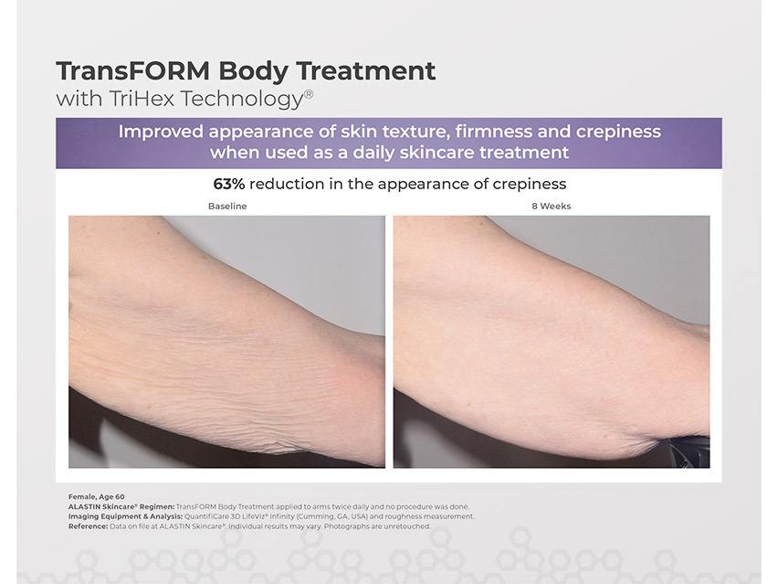 ALASTIN Skincare TransFORM Body Treatment with TriHex Technology