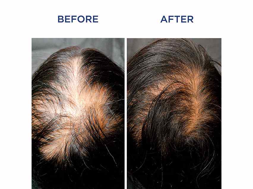 PHYTO Phytocyane Densifying Treatment for Women