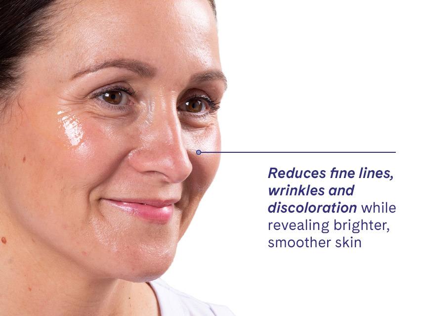 LovelySkin LUXE Advanced Retinol Serum