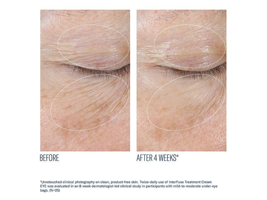 skinbetter science InterFuse Treatment Cream Eye