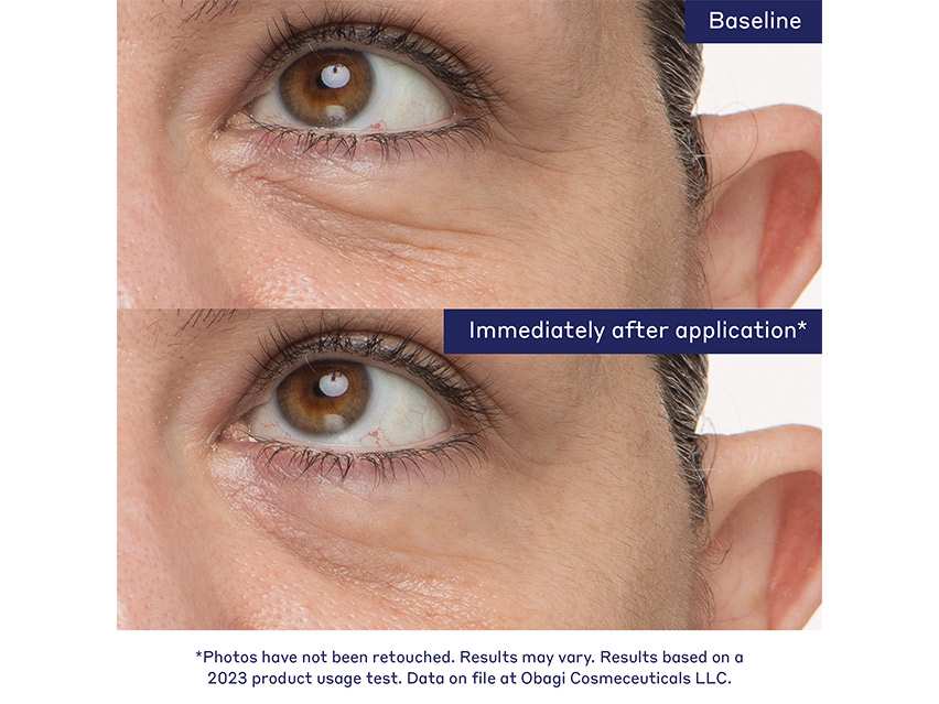 Obagi Daily-Drops Rejuvenating Eye Gel Cream