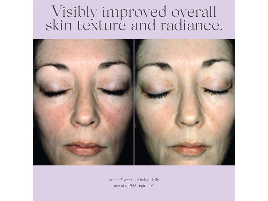 Exuviance Overnight Transformation Complex