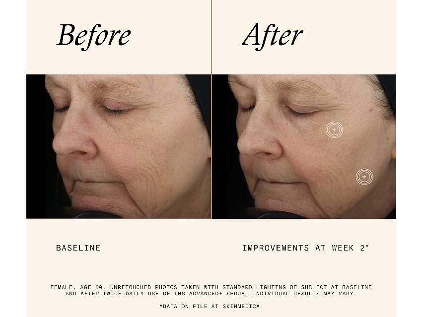 SkinMedica TNS® Advanced+ Serum