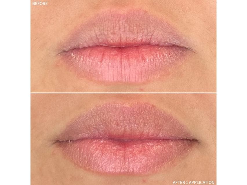 RescueMD Restorative Lip Treatment