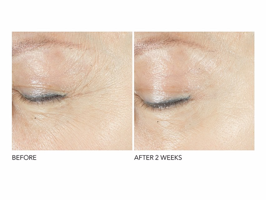 Dr. Dennis Gross Skincare Advanced Retinol + Ferulic Triple Correction Eye Serum