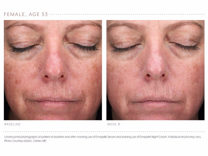 Emepelle Serum