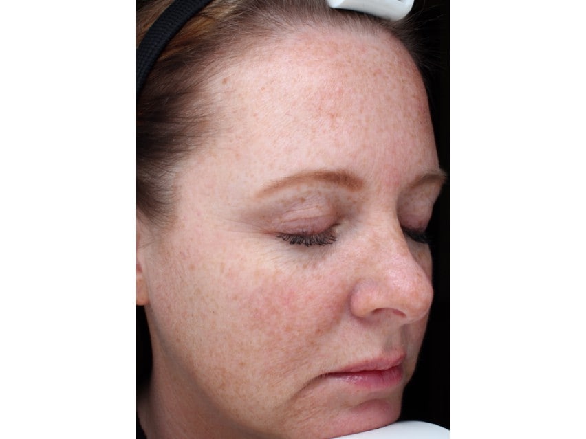 SENTE Bio Complete Serum