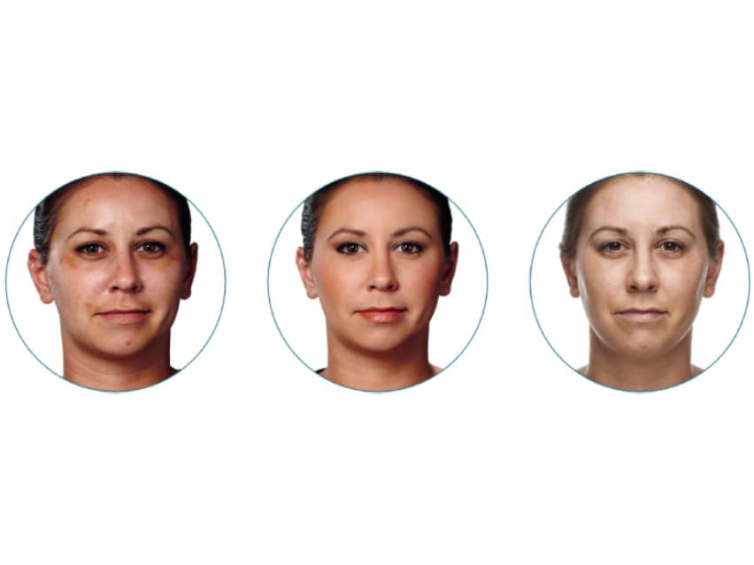 Colorescience Even Up Clinical Pigment Perfector SPF 50