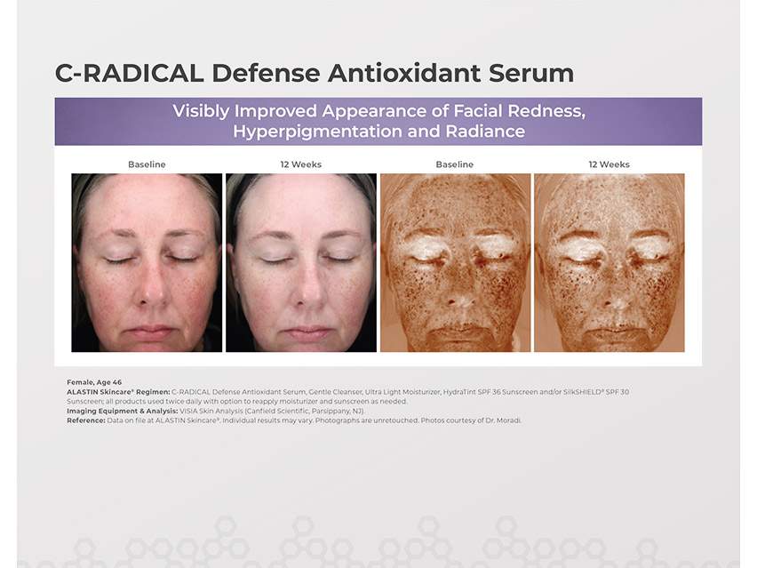 ALASTIN Skincare C-RADICAL Defense Antioxidant Serum