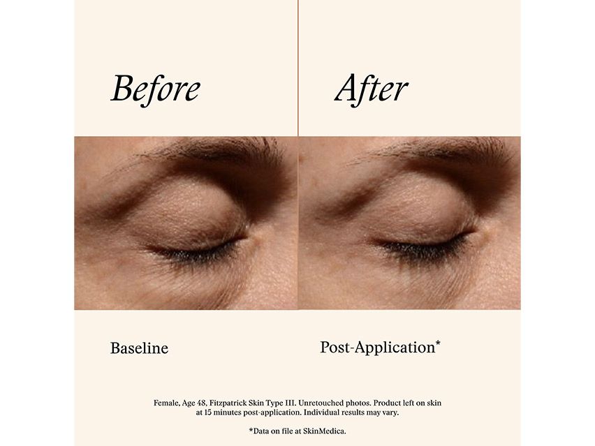 SkinMedica Instant Bright Eye Cream