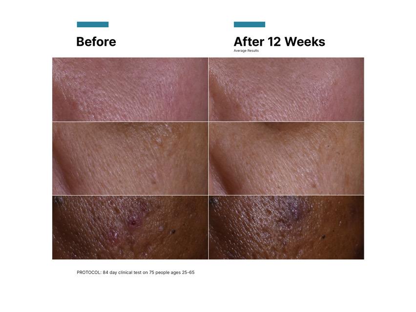 SkinCeuticals C E Ferulic Antioxidant Serum