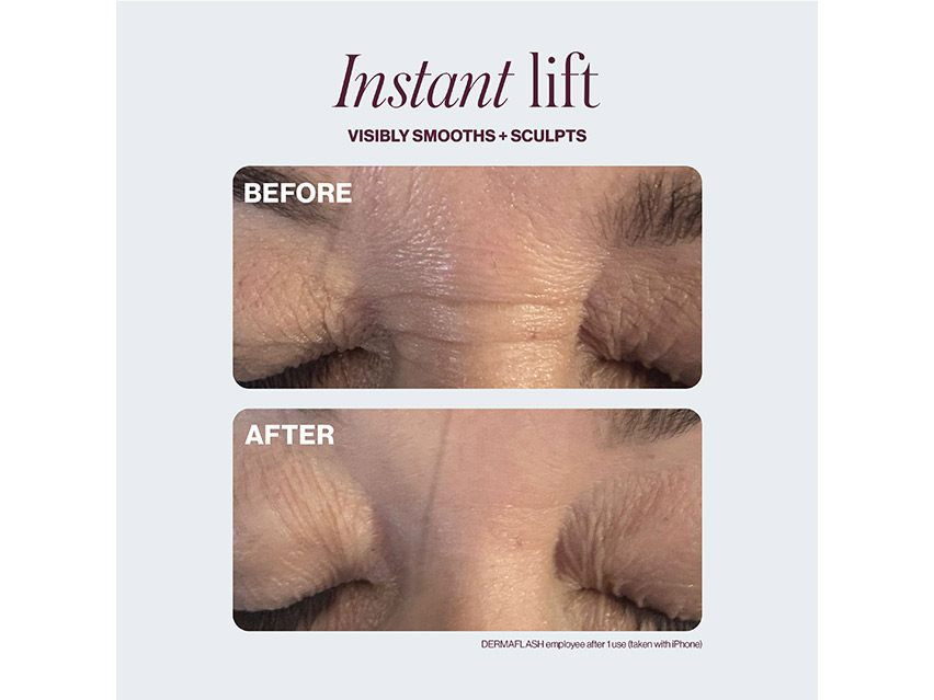 DERMAFLASH COOL Sonic Depuffing and Lymphatic Drainage Set