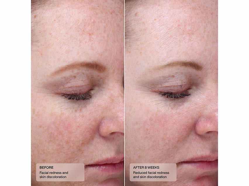 Sentè Bio Complete Serum