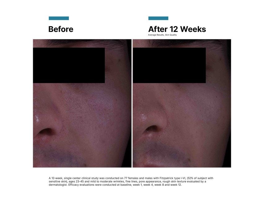 SkinCeuticals P-TIOX Wrinkle Modulating Peptide Cream