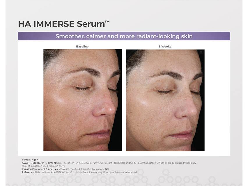 ALASTIN Skincare HA IMMERSE Serum