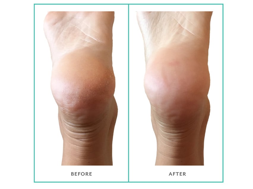 patchology PoshPeel Pedicure