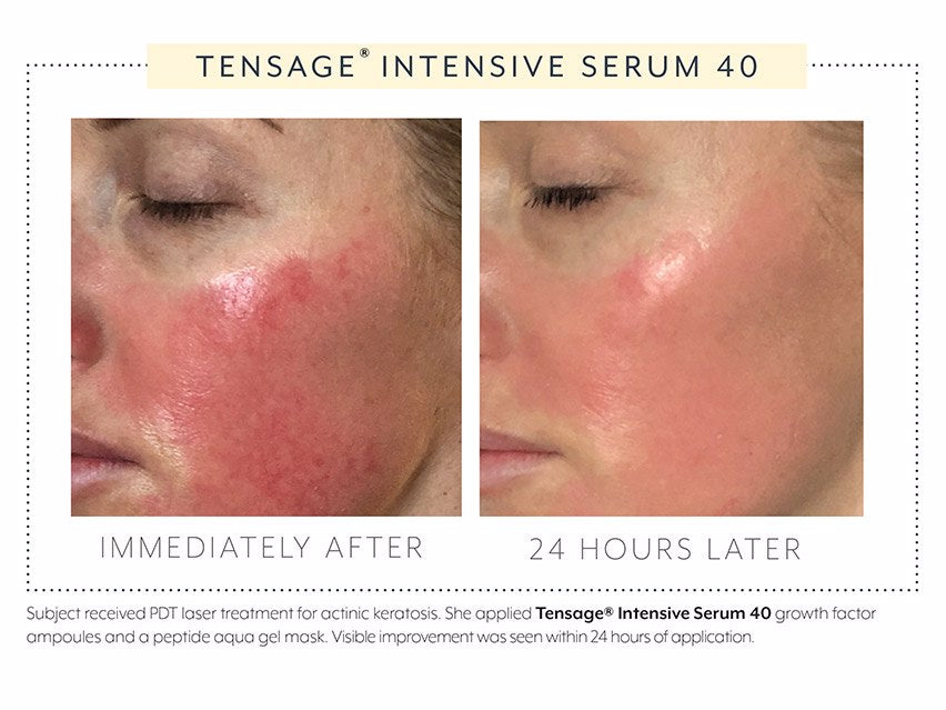 Biopelle Tensage Intensive Serum 40