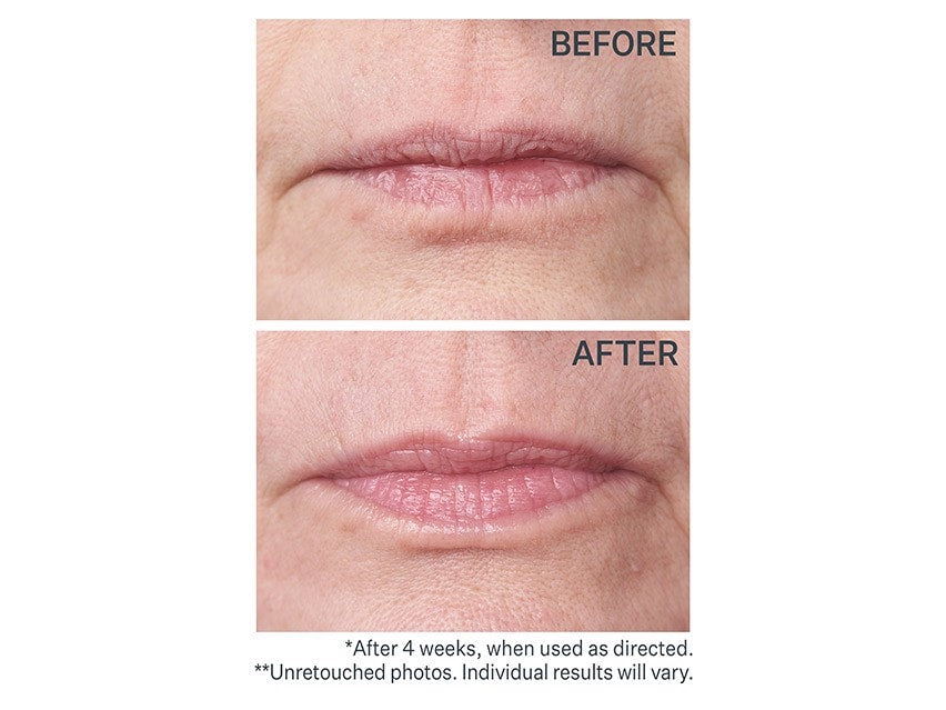 StriVectin Double Fix for Lips Plumping & Vertical Line Treatment