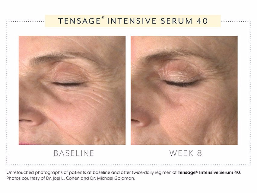 Biopelle Tensage Intensive Serum 40